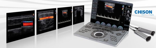 Ecograf CHISON Sonoair 70 - imagine 2