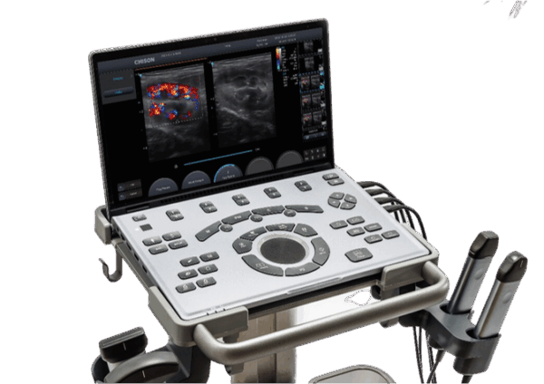 Ecograf CHISON Sonoair 70